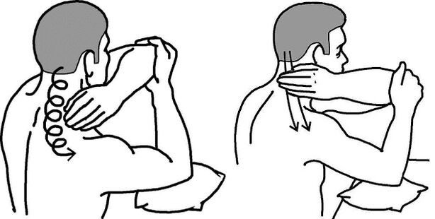 Mapas de automóvil para la osteocondosis del cuello