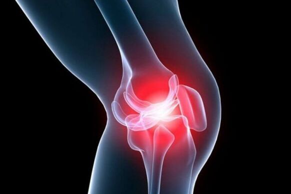 artrosis de la articulación de la rodilla