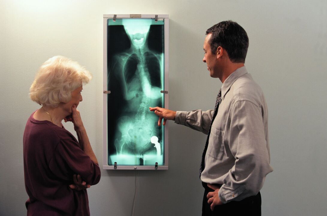 diagnóstico de rayos x para el dolor en las articulaciones de la cadera
