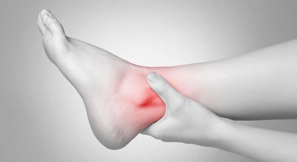 La rigidez de las articulaciones y el dolor crónico de tobillo son complicaciones de la artritis cruzada