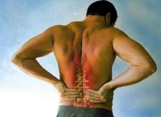 Dolor para la osteocondosis lumbar